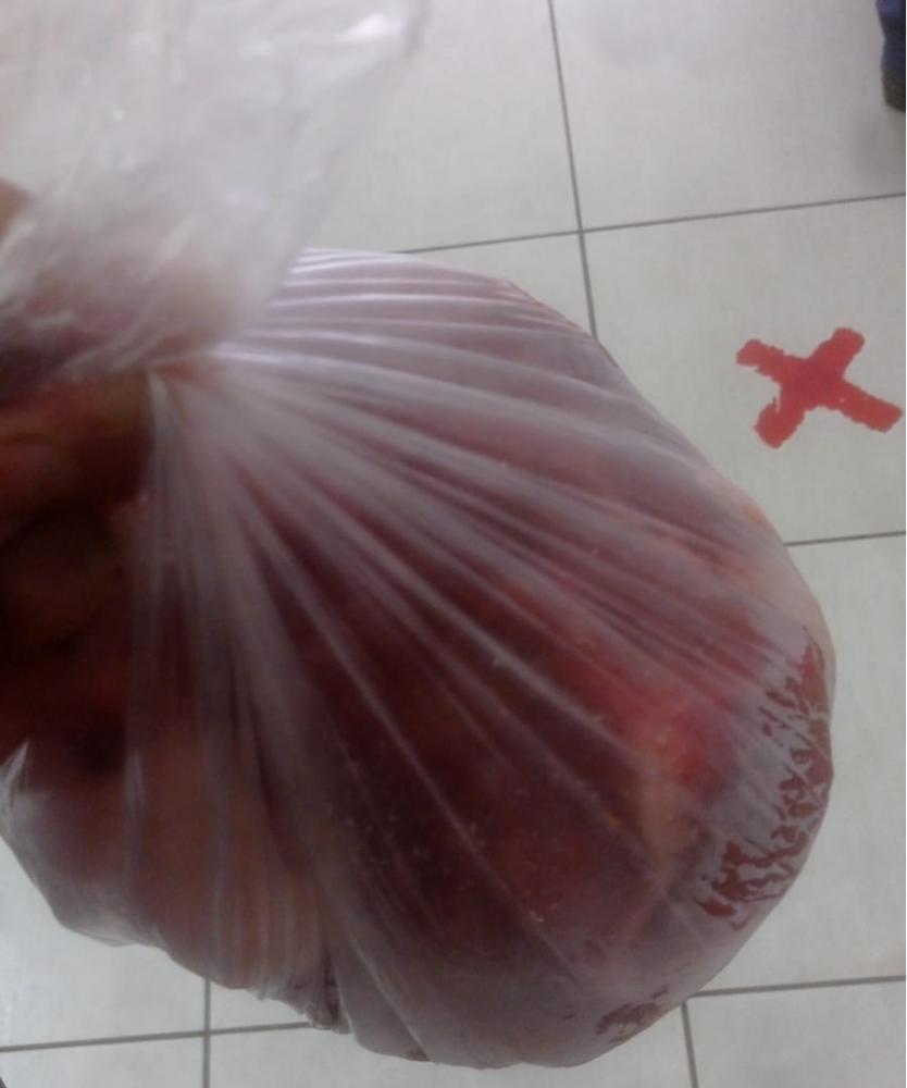 Mulher é agredia pelo filho com pacote de carne congelada e vai parar no hospital