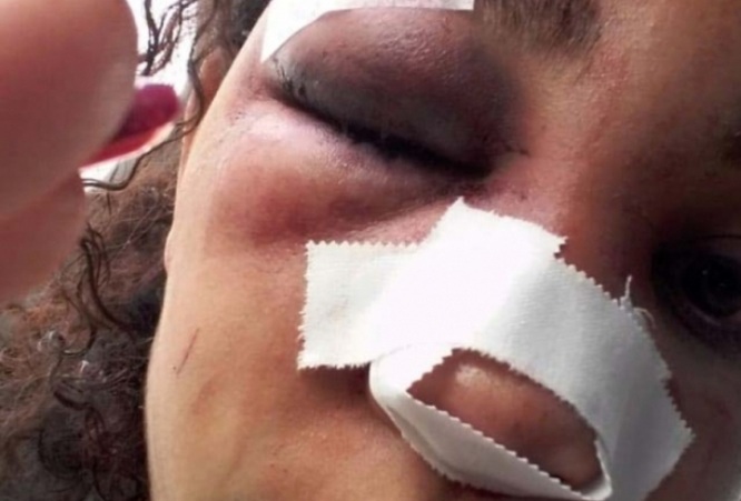 Homem embriagado e drogado é preso após quebrar o nariz da namorada