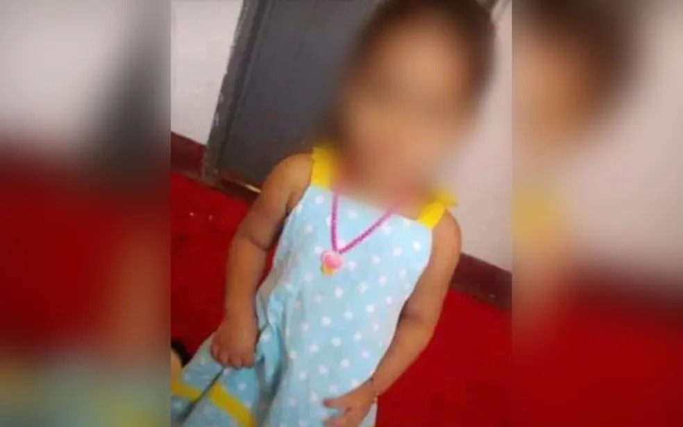 Mãe e madrasta espancam criança de 4 anos até menina ficar desfigurada