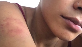 Mulher é espancada pelo marido e vai parar no hospital