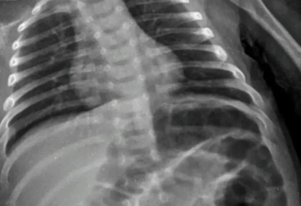 Casal é preso suspeito de tentar matar filho de apenas 40 dias no Paraná