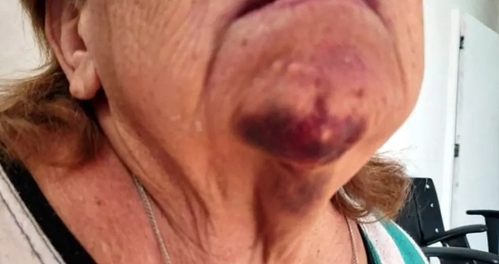 Filho espanca a mãe de 70 anos e tenta matar a idosa enforcada