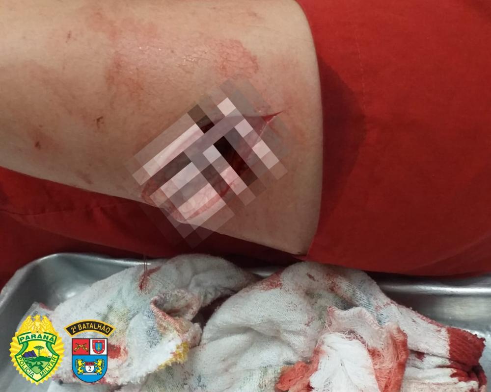 Briga de mulheres termina com facadas e vítima levada ao hospital