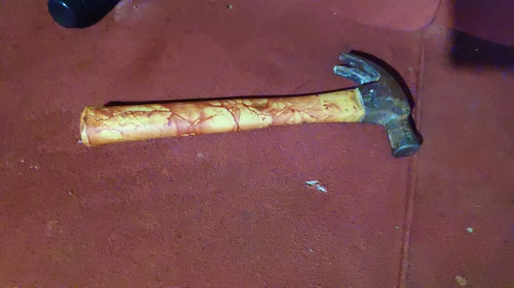 Mulher perdoa o ex-marido violento e leva martelada na cara