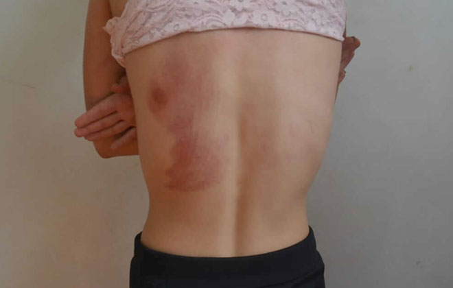 Criança chama a PM após ver sua irmã ser agredida pelo marido