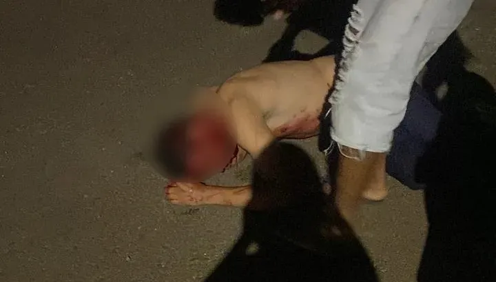 Homem vai parar no hospital após levar tiro na cabeça