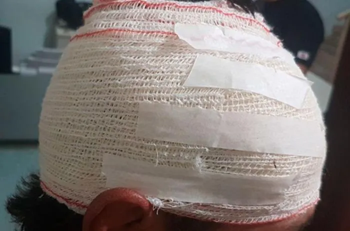 Homem leva pancada com barra de ferro na cabeça e vai parar no hospital