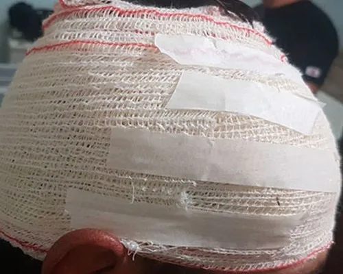 Padrasto dá facada na nuca do enteado durante briga de família