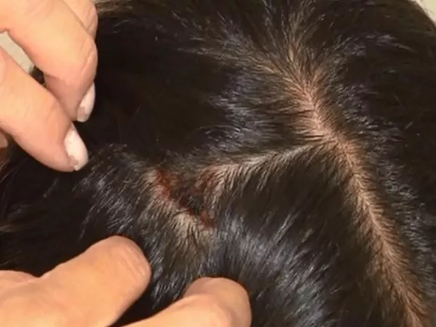 Mulher é agredida e arrastada pelos cabelos durante assalto a mão armada