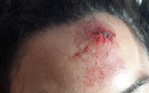 Mulher é espancada pelo marido e chega a perder o dente