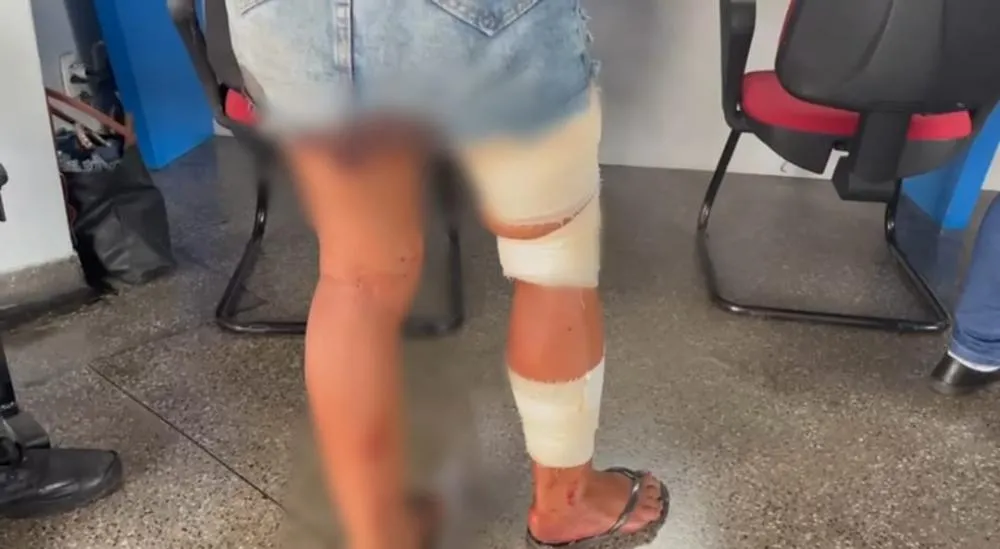 Discussão entre mulheres termina com uma delas esfaqueada