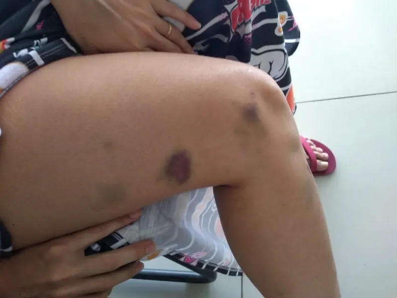 Agressor espanca a esposa grávida com socos e chutes