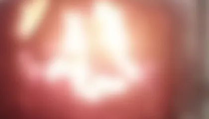 Adolescente joga filhotes de cachorro vivos no fogo e grava vídeo com animais gritando