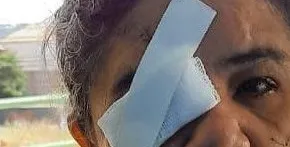 Esposa dá facada no olho de uma mulher após desconfiar de traição