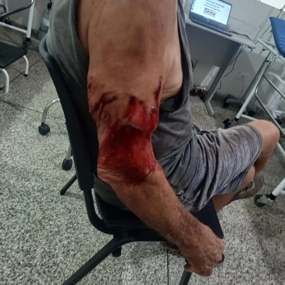 Idoso é atacado por cachorro e fica ferido em São José da Boa Vista