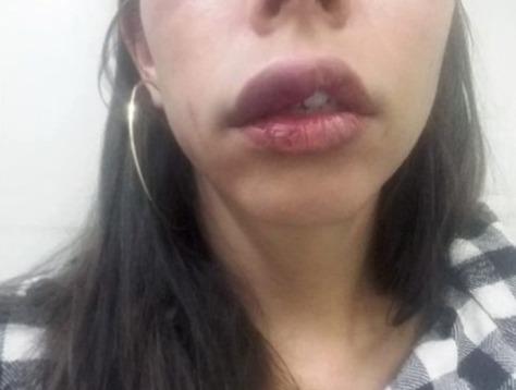 Mulher com bebê no colo apanha do marido
