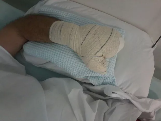 Homem vai parar no hospital e acaba preso após dar tiro na própria mão