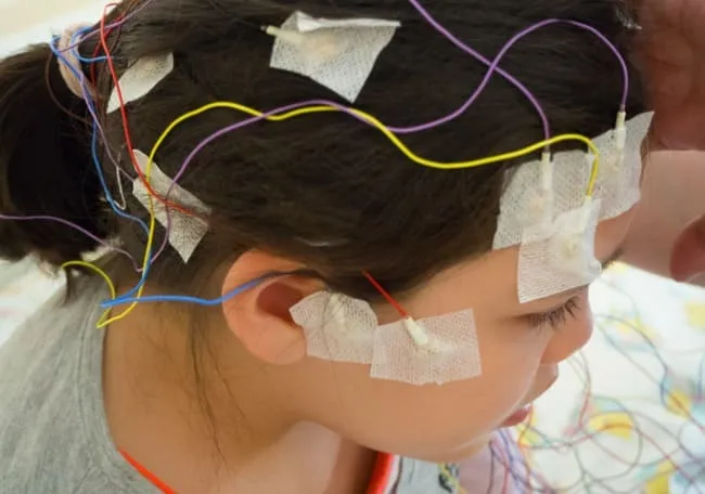 Casos de AVC em crianças e adolescentes colocam pais em alerta; conheça os sinais