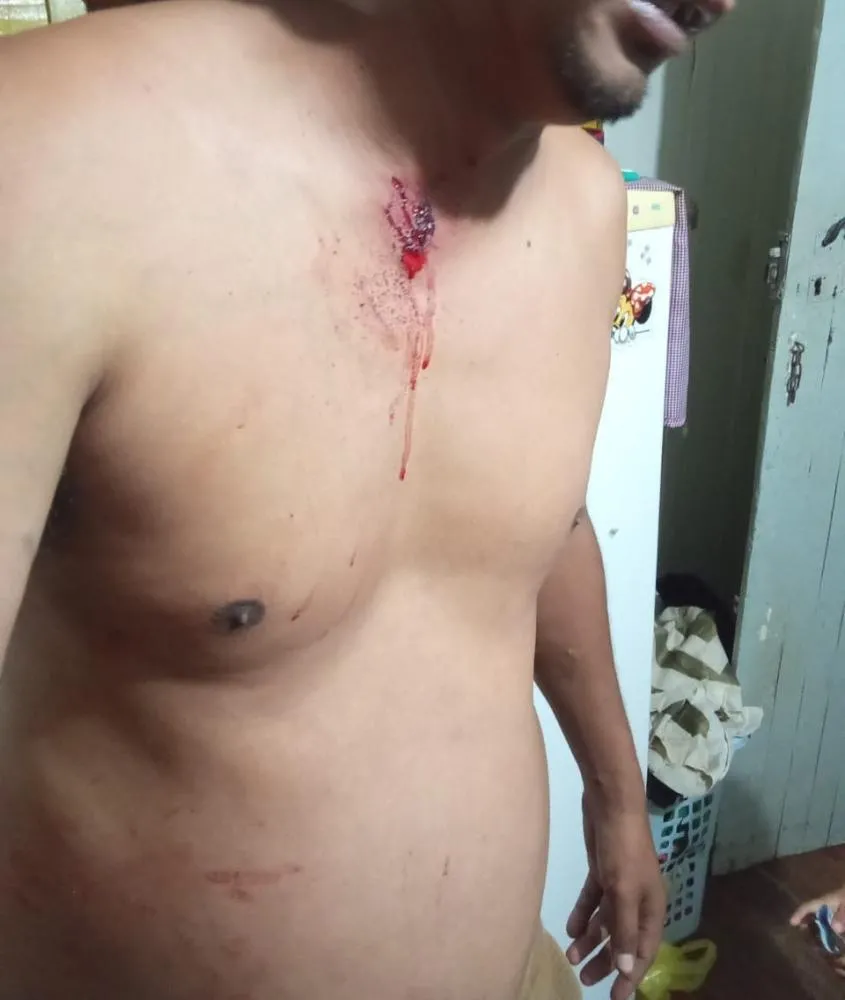 Irmãos ficam gravemente feridos após serem atacados por PitBulls em São José da Boa Vista