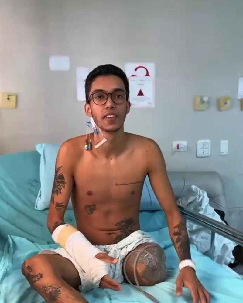 Após perder a perna em acidente, jovem de Jacarezinho pede ajuda para comprar prótese e continuar tratamento