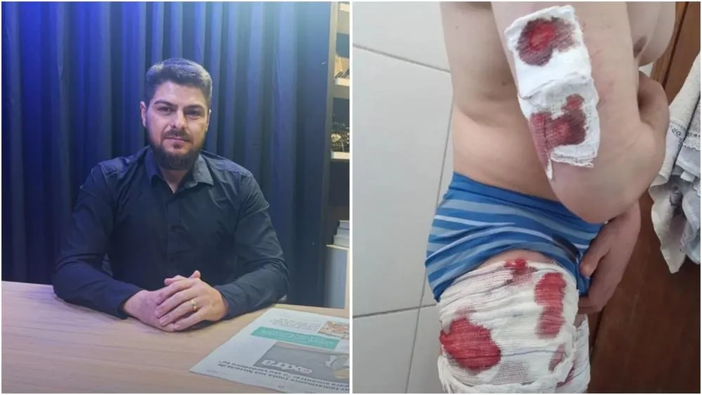 “Pensei que morreria ali”, conta morador que enfrentou PitBulls para salvar casal de  idosos