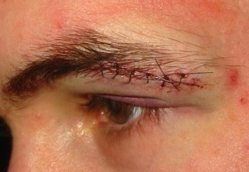 Estudante fica ferido após ser agredido em escola