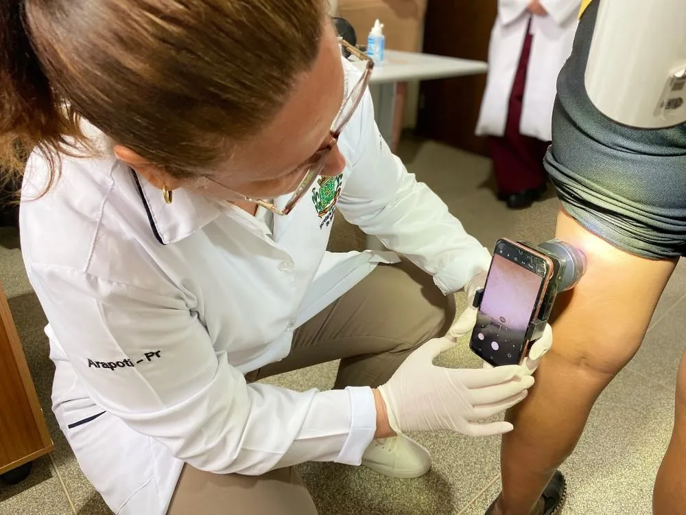 Arapoti investe em tecnologia para agilizar diagnóstico precoce de câncer de pele