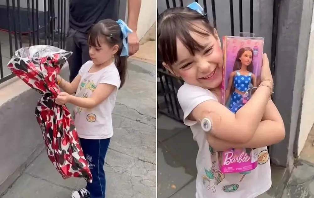 Garotinha ganha uma Barbie com a mesma condição que a dela e tem a reação mais encantadora