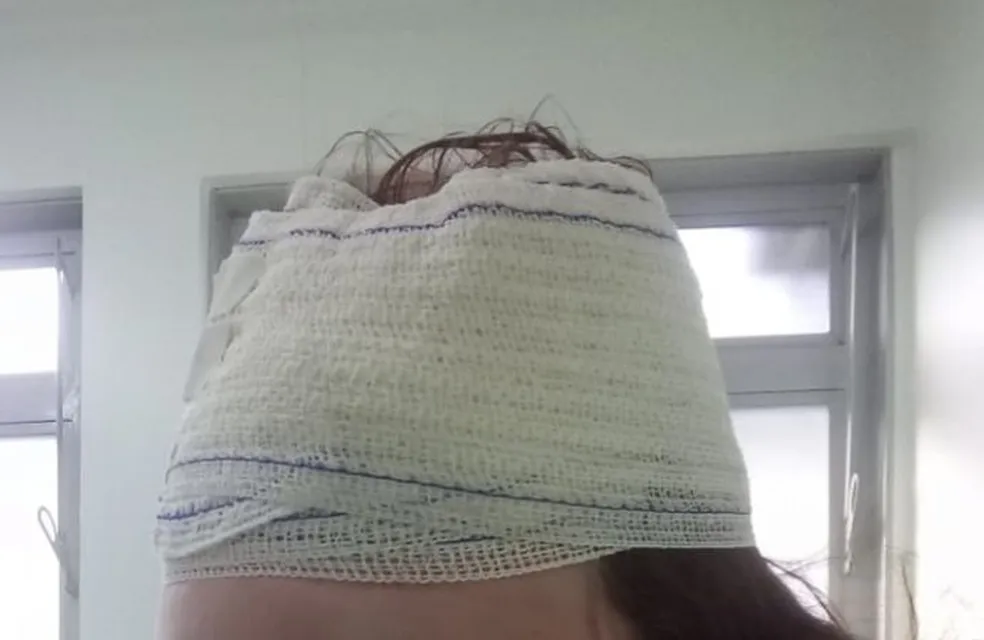 Mulher vai parar no hospital após o irmão abrir sua cabeça com uma pratada