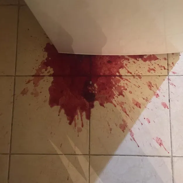 Mulher fica em estado grave após ser atacada com golpes de facão na cabeça