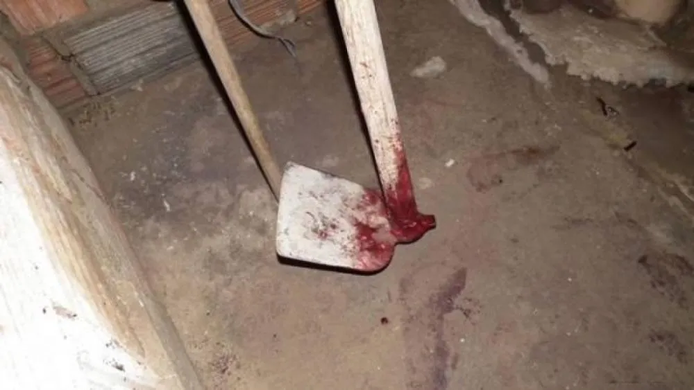 Homem fica em estado grave após ser atingido com golpe de enxada na cabeça