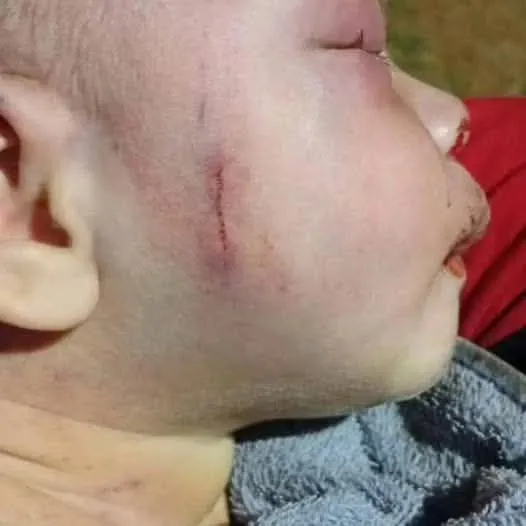 Menina de cinco anos salva irmão recém-nascido que estava sendo espancado pelo pai