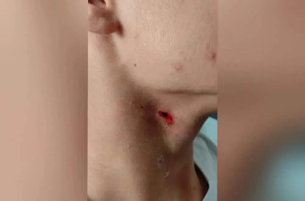 Briga em colégio dos Campos Gerais termina com aluno ferido após golpe no pescoço