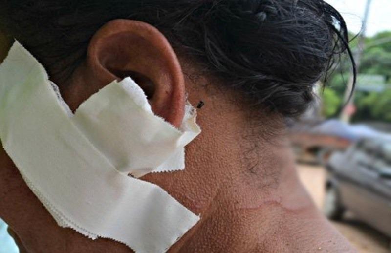 Mulher é espancada após assaltantes não encontrarem dinheiro em bar