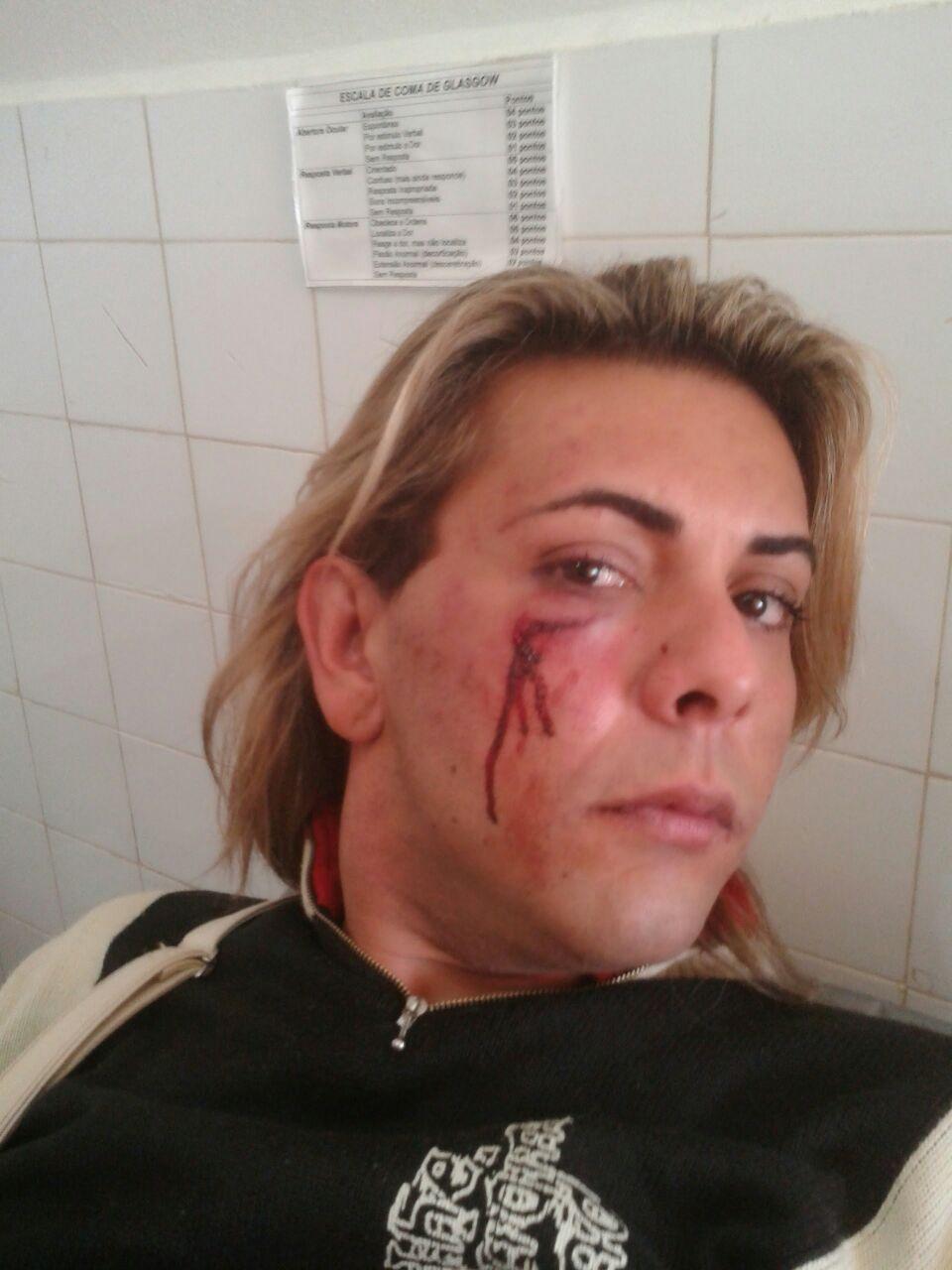 Após vencer concurso, modelo trans é vítima de agressão