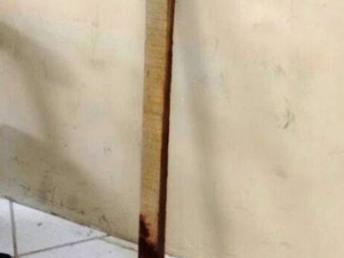 Homem é agredido com pauladas na cabeça e fica em estado grave