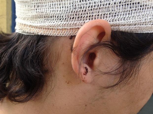 Homem dá tijolada na cabeça da esposa