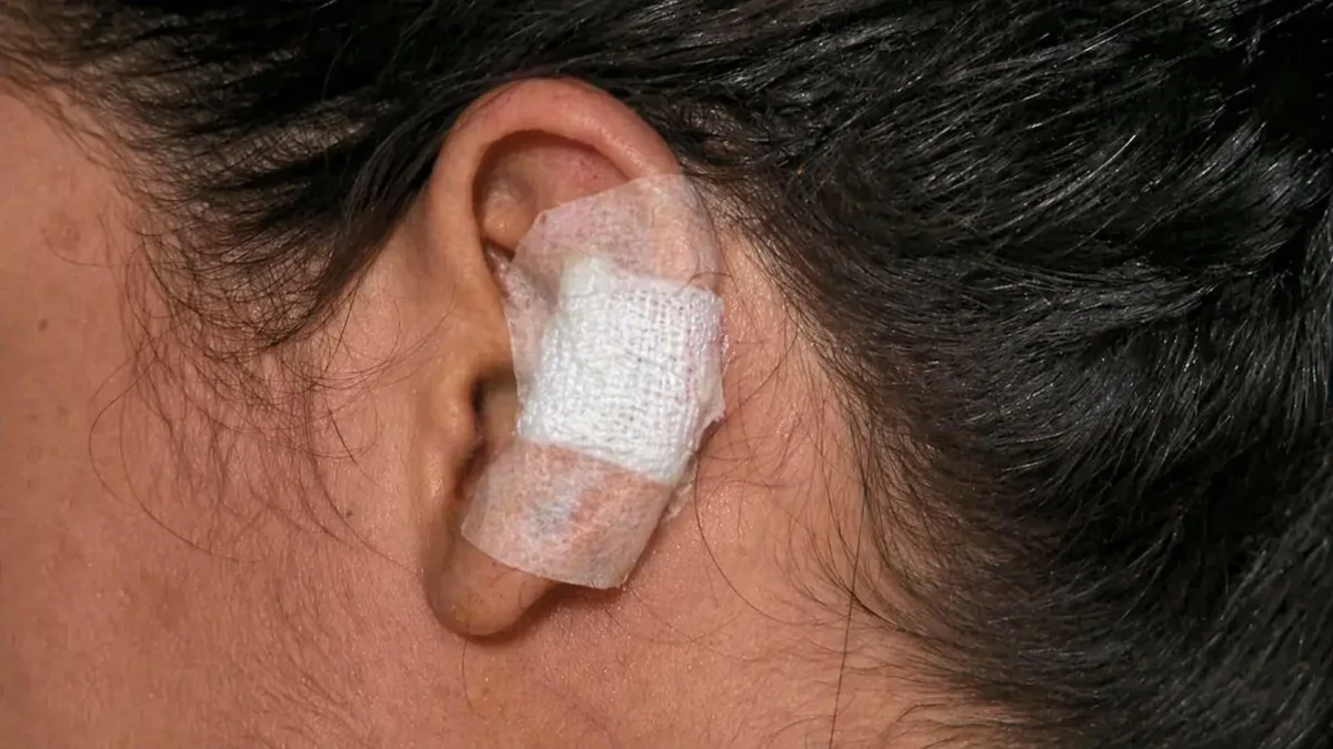 Homem pega mulher na casa de amiga, espanca e morde sua orelha